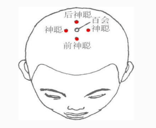 转存图片
